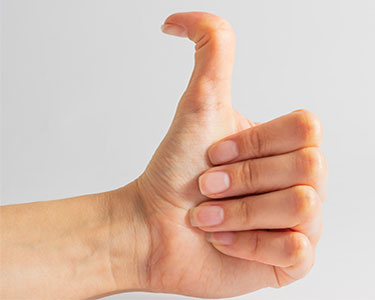 Hypermobility can cause joint pain and other issues - Airdrie NUCCA chiropractor Michelle Speranza can help.